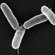 Bacteria Salmonella entérica. Foto: Wikipedia